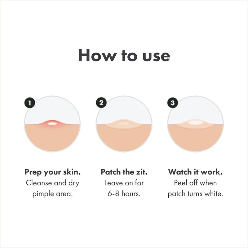 Acne Patch Day Night Repair