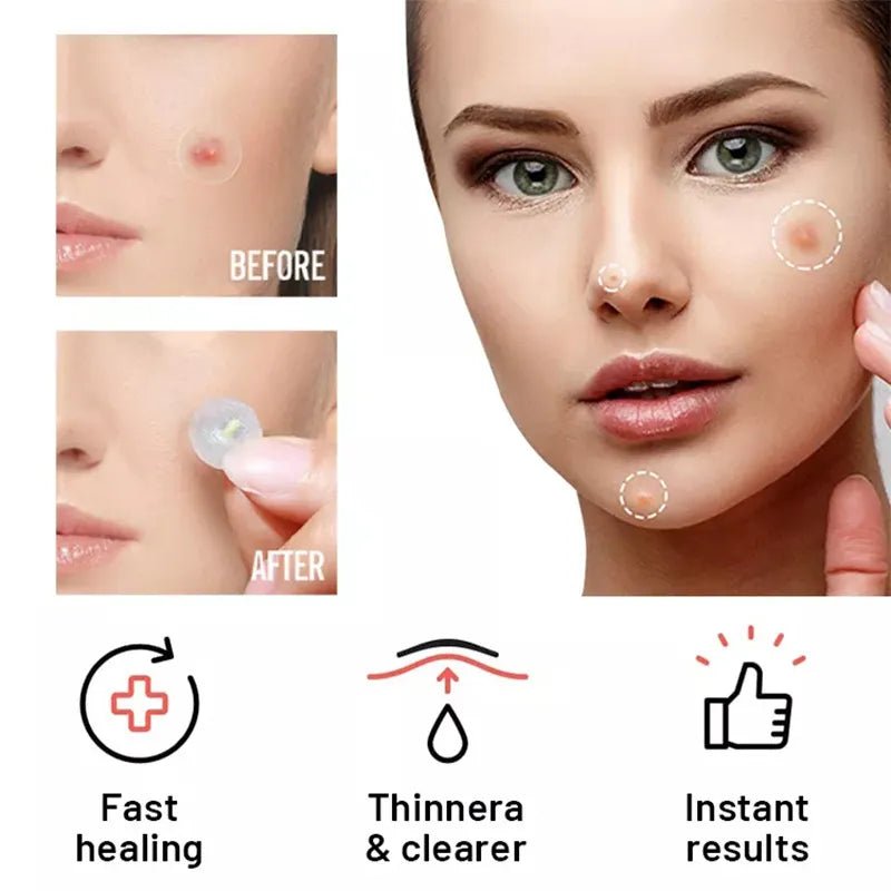 Acne Patch Day Night Repair - WowStore.live