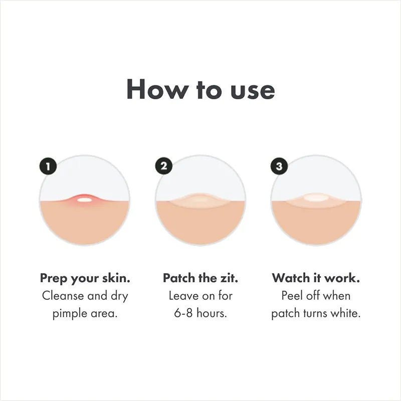 Acne Patch Day Night Repair - WowStore.live