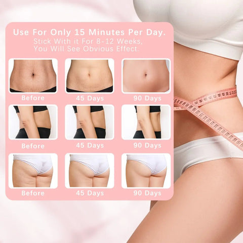 Electric Fat Remover - Wow Store