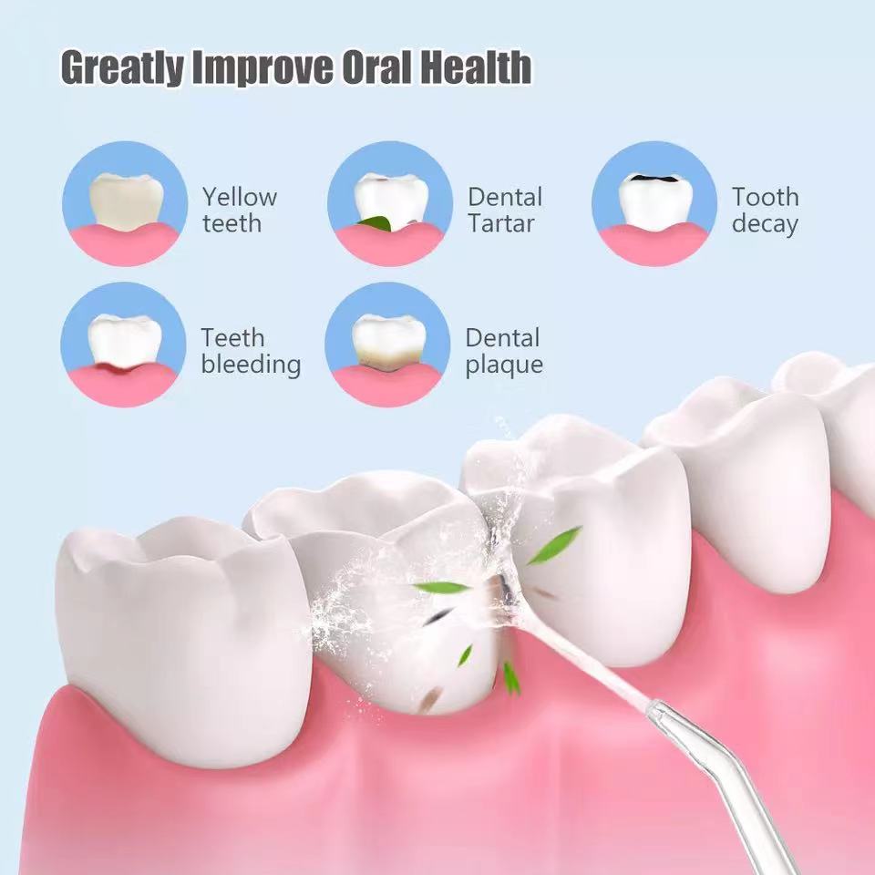 Waterproof Irrigator Dental Cleaner - Wow Store